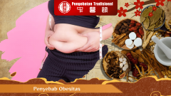 Penyebab Obesitas dan Cara Mencegahnya, Simak Disini!