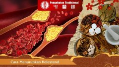 Terbukti! Begini Cara Mengatasi Penuaan Dini, Catat!