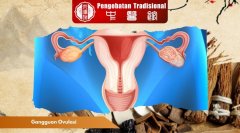 Cara Mendeteksi Gangguan Ovulasi Sejak Dini, Intip Disini!