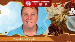 Apa Itu Penyakit Bell's Palsy? Yuk, Pahami Penyebab dan Geja