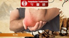 Apa itu Bursitis? Kenali Gejala, Penyebab, dan Cara Mengatas