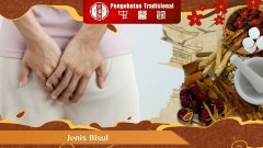 Hati-Hati! Inilah Jenis Bisul yang Membahayakan