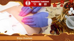 Mengenal Kista Ovarium: Apakah Berbahaya?