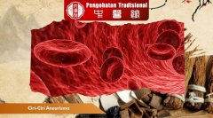 Ciri-Ciri Aneurisma yang Perlu Diwaspadai Sejak Dini
