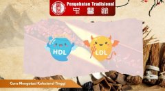 Cara Mengatasi Kolesterol Tinggi pada Usia Muda, Baca!
