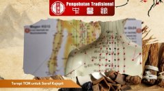 Terapi TCM untuk Saraf Kejepit: Langkah Alami Atasi Nyeri