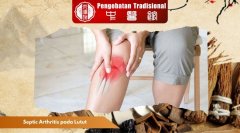 Septic Arthritis pada Lutut: Bahaya dan Langkah Pencegahanny