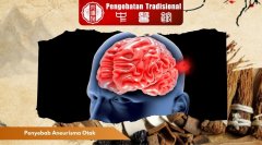 Penyebab Aneurisma Otak yang Sering Diabaikan