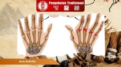 Jenis Arthritis dan Cara Mengenali Gejalanya