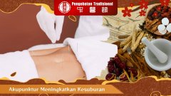 Terapi Akupunktur untuk Meningkatkan Kesuburan