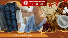 Tanda Awal Stroke: Kenali Gejalanya Sebelum Terlambat