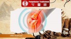 Infeksi Sendi Lutut: Penyebab, Gejala, Penanganan