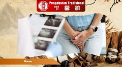Inilah Ciri-Ciri Mioma yang Wajib Wanita Ketahui, Simak!