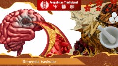 Demensia Vaskular: Penyebab, Gejala, dan Cara Pencegahannya