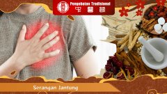 Ketahui, Berikut 6 Penyebab Serangan Jantung yang Berbahaya