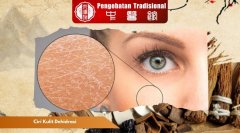 Waspada! Ini Ciri Kulit Dehidrasi yang Memicu Penuaan Dini