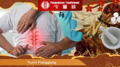 Penyebab Nyeri Punggung dan Solusi yang Bisa Anda Coba