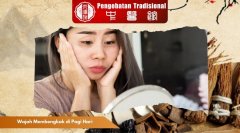 Wajah Membengkak di Pagi Hari? Ini Penyebab dan Solusinya