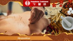 5 Alasan Mengapa Akupunktur Bisa Jadi Pengobatan Masa Depan