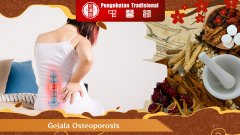 Kenali 7 Gejala Osteoporosis Sebelum Terlambat!