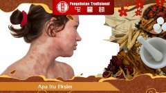 Apa Itu Eksim? Kenali Musuh Kulit yang Diam-Diam Menyiksa